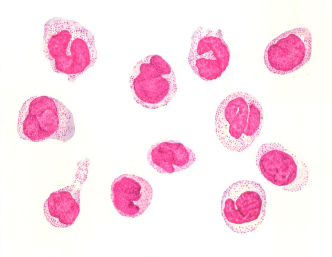 单核细胞涂片图片